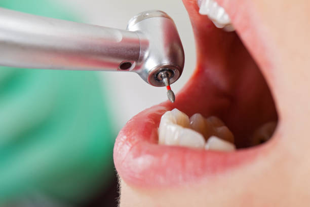 Best Emergency Dental Surgery in St Paul, MN
